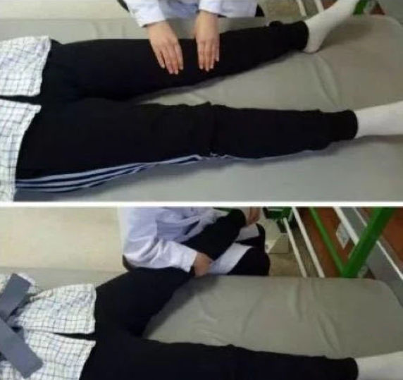 膝過伸不煩惱，康復訓練有妙招